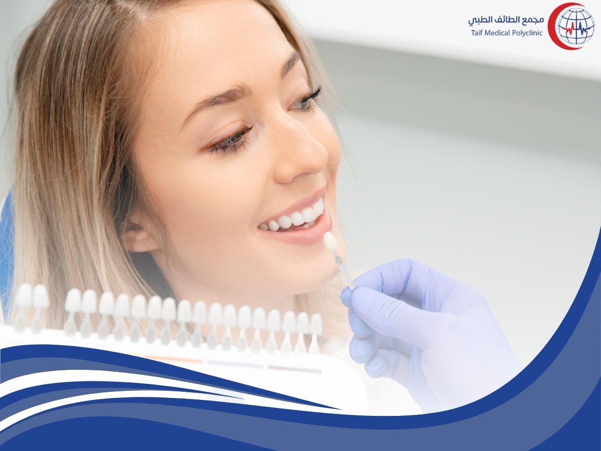 عدسات الأسنان: أنواعها، فوائدها، وكيفية اختيار الأفضل لابتسامتك Dental Veneers: Types, Benefits, and How to Choose the Best One for Your Smile