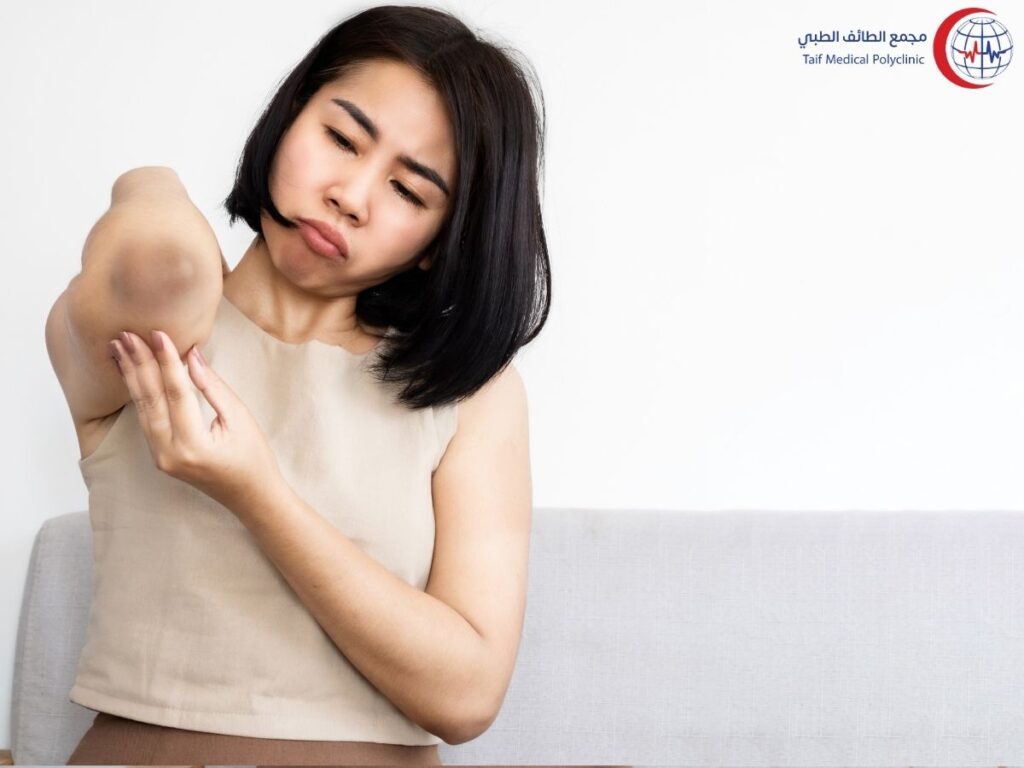 العلاج الفعال لاسمرار الركب والأكواع Effective treatment for dark knees and elbows
