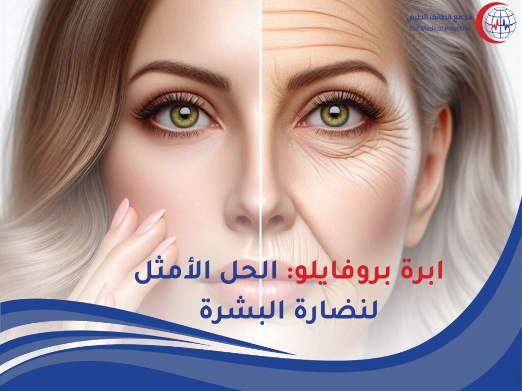 ابرة بروفايلو: الحل الأمثل لنضارة البشرة بأفضل سعر في الرياض Profhilo needle: the perfect solution for skin freshness at the best price in Riyadh