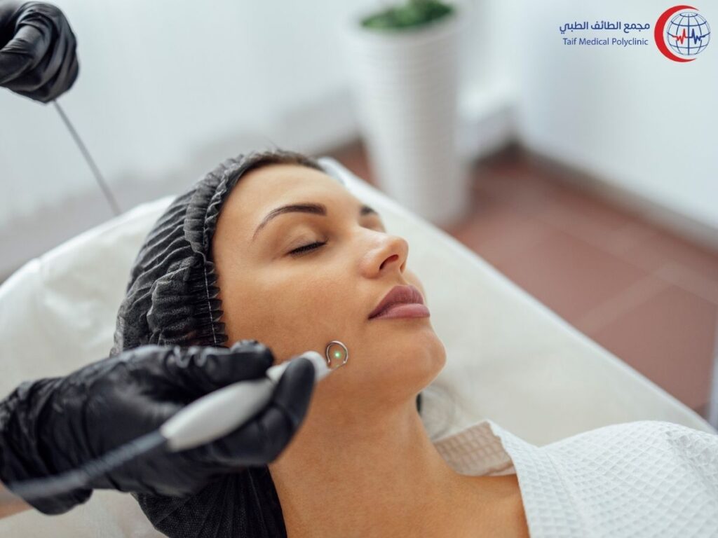 فوائد وأضرار علاج تصبغات الجلد بالليزر Benefits and harms of laser skin pigmentation treatment