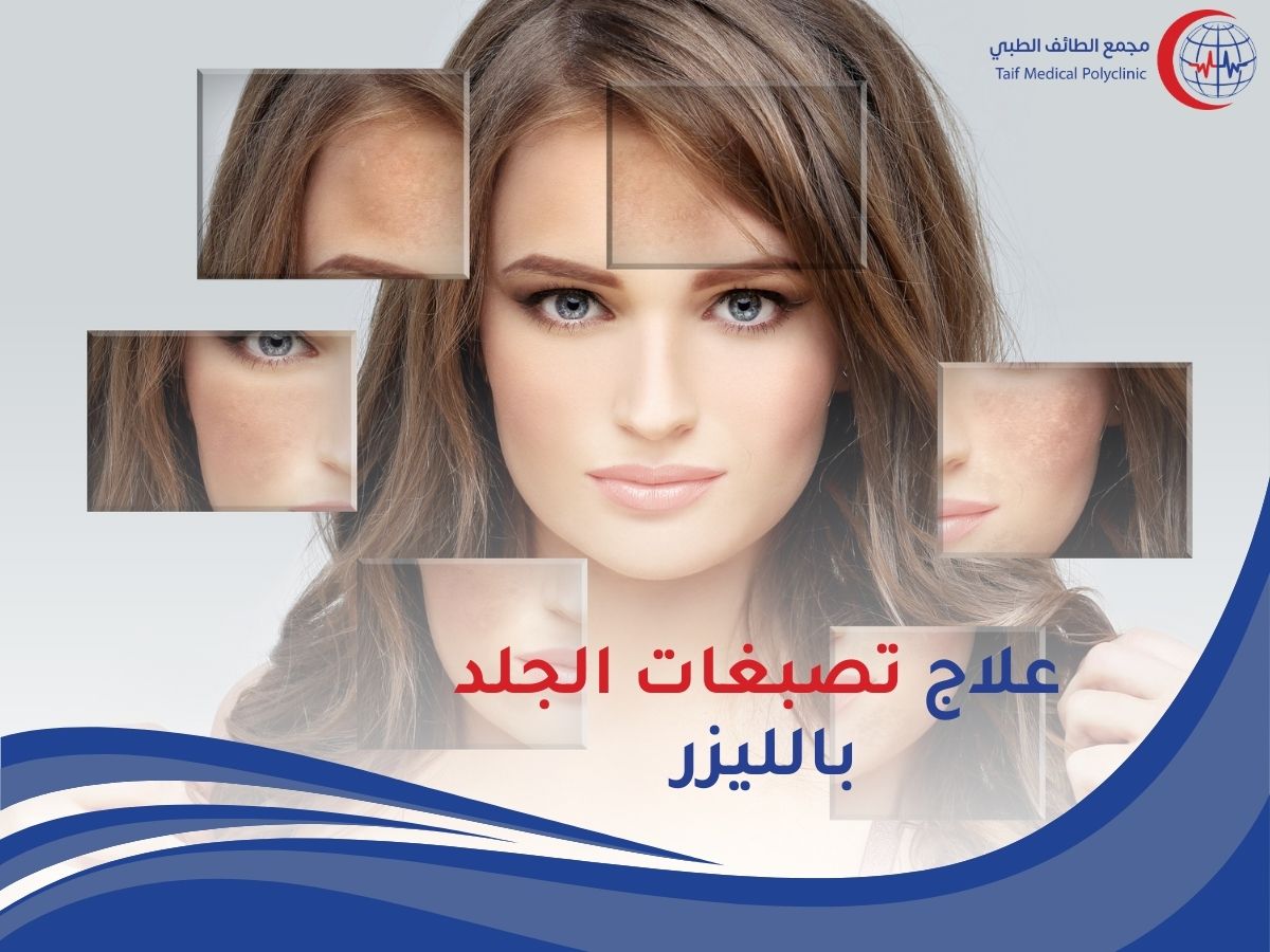 فوائد وأضرار علاج تصبغات الجلد بالليزر Benefits and harms of laser skin pigmentation treatment